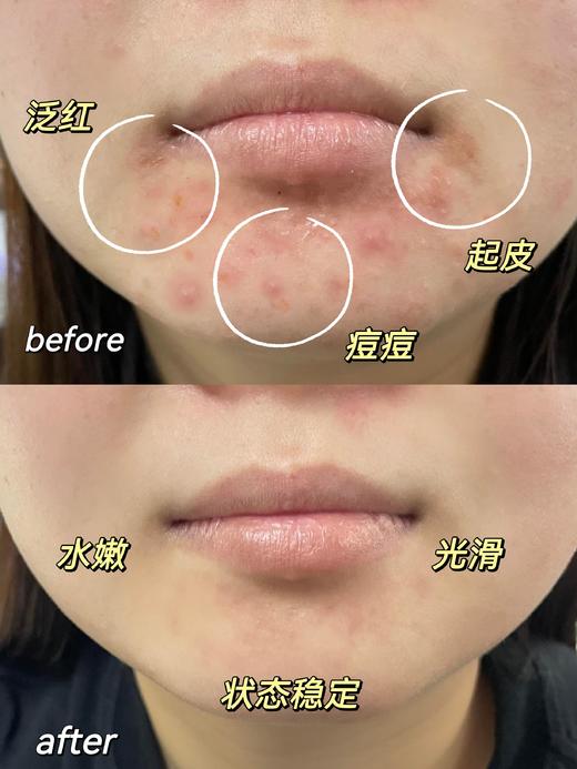 【7天发货】【买二送一】澳洲鸸鹋油 30g/瓶 商品图3