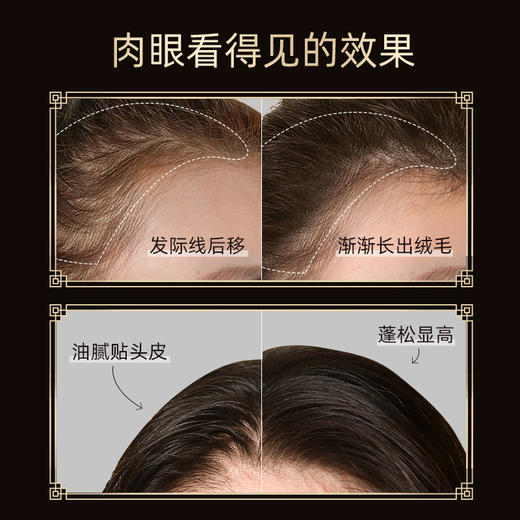 北京同仁堂菲丝宜防脱洗发露500ml 商品图4