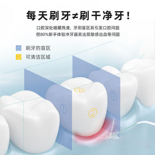 【送三喷嘴】usmile冲牙器水牙线洗牙器家用便携电动口腔牙齿正畸专用密浪 商品图6