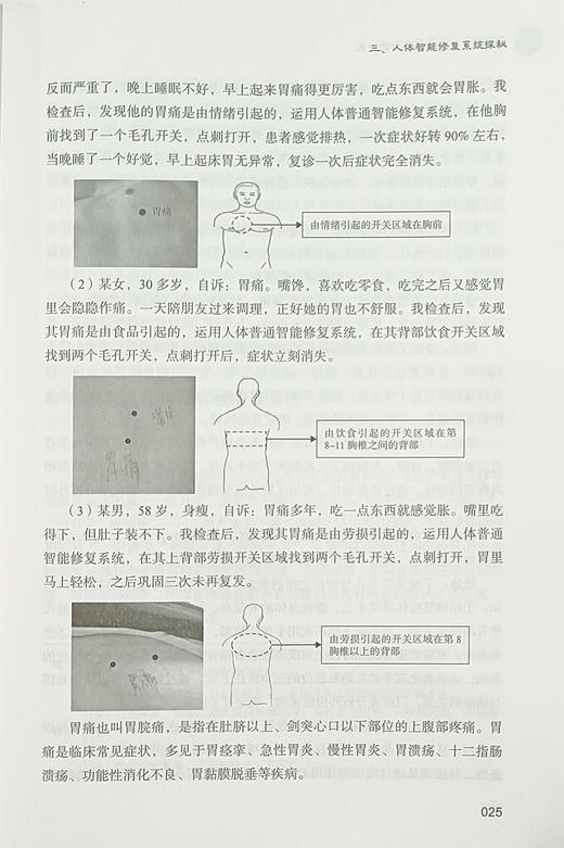 修复力：唤醒人体智能修复 祝一萍 高荣荣 主编 一个毛孔 一根微针 让您拥有更健康的人生 中医古籍出版社9787515224503 商品图4