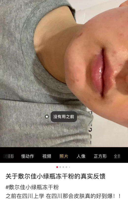 敷尔佳冻干粉小绿瓶 商品图4