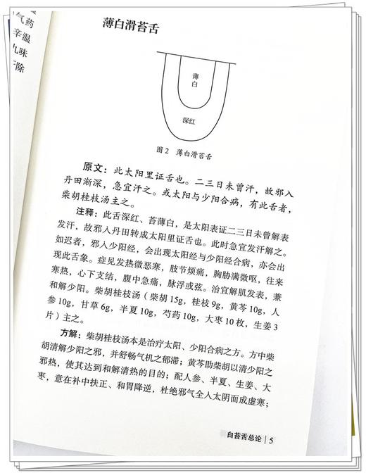 伤寒舌鉴注释 第二版 马一森 舌诊辨证图谱中医养生书籍中医诊断学书舌像舌苔辨析临床全书 中国中医药出版社9787513277419 商品图4