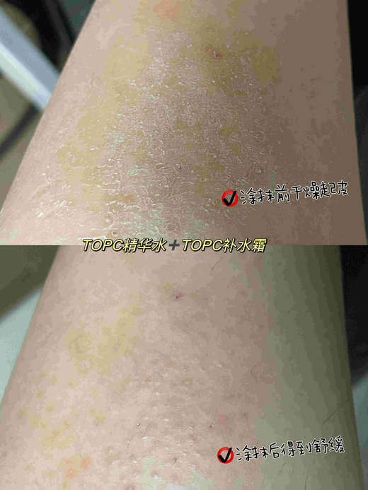 【TOPC洋甘菊保湿霜】持久补水保湿，改善肌肤干燥！一抹即化成精华质感，吸收快不油腻，巨滋润！大人小孩孕妇，全家都能用！50g/罐！ 商品图6