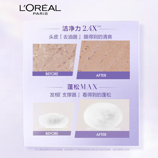 欧莱雅玻尿酸洗发水护发素去油蓬松清爽控油无硅油女洗发露洗头膏润发乳洗护套装【朱一龙亲选】 商品图5