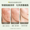 【⚡抢！79元任选2件】祛痘痘印痘坑非修复淡化去痘印痘疤凹洞膏男女正品 商品缩略图3