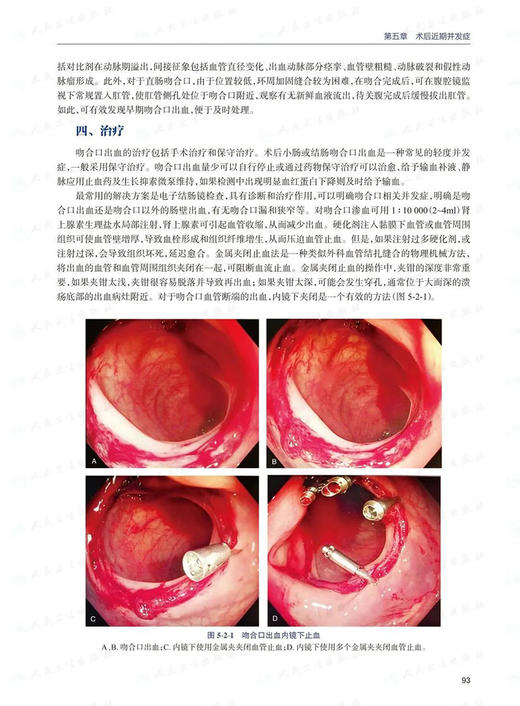 结直肠肿瘤诊治并发症的预防和处理 王锡山 韩方海 戴勇 结直肠癌手术放疗化疗靶向治疗和免疫治疗等 人民卫生出版社9787117339094 商品图4