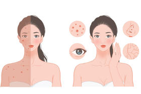 肌肤干燥易瘙痒？来碗甜糯银耳羹，滋阴养颜还嫩肤！