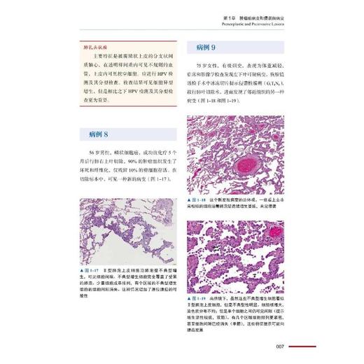 肺病理诊断图谱 商品图1