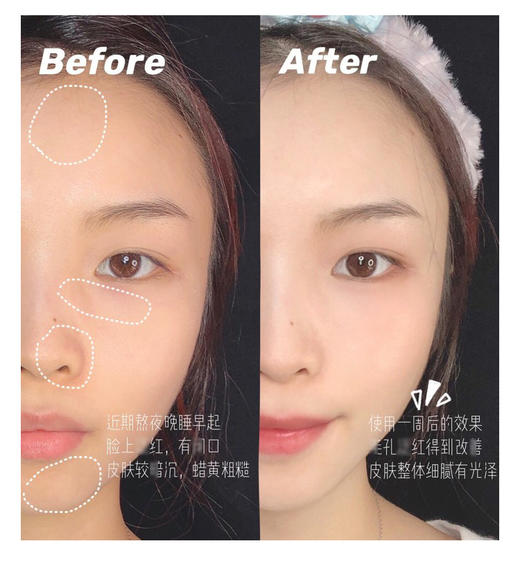 【清仓好价】韩国Dr.Althea角鲨烷蚕丝保湿面膜/金缕梅调理舒缓面膜 5片/盒 （效期至23.7） 商品图2