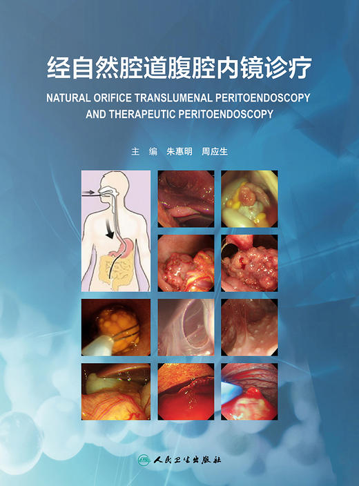 经自然腔道腹腔内镜诊疗 9787117331593 2022年12月参考书 商品图1