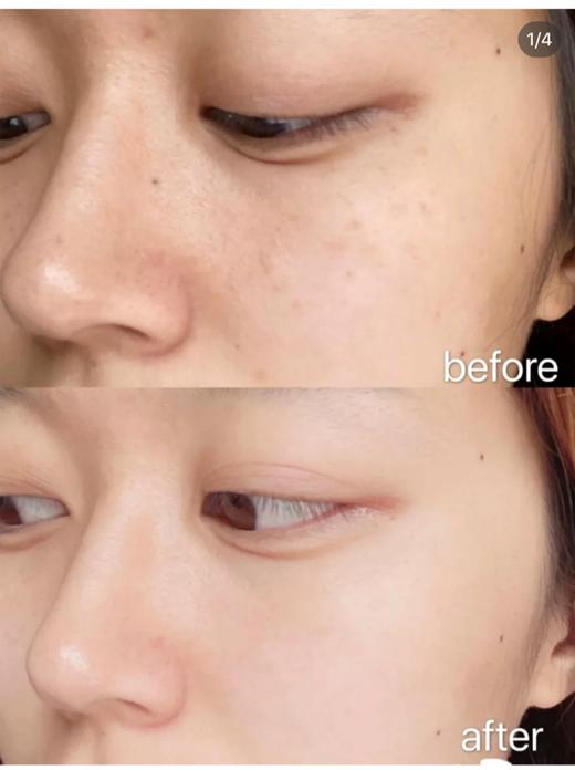 【新品上新】法国欧缇丽 臻美亮白精华液10ml*3 商品图2