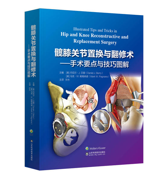 髋膝关节置换与翻修术：手术要点与技巧图解 主译 孙水 山科出版 商品图0