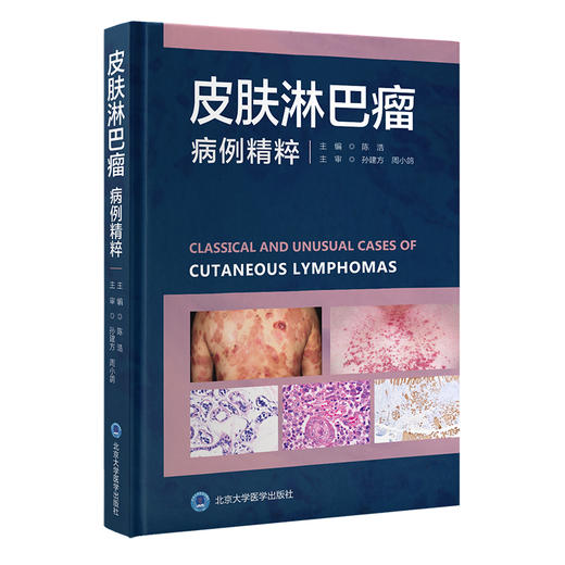 皮肤淋巴瘤病例精粹 陈浩 主编 北医社 商品图0