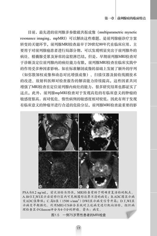 前列腺MRT：实践指南 孙昊 王海屹 张古沐阳 主译 前列腺疾病核磁共振成像诊断学指南 科学技术文献出版社9787518990825 商品图3