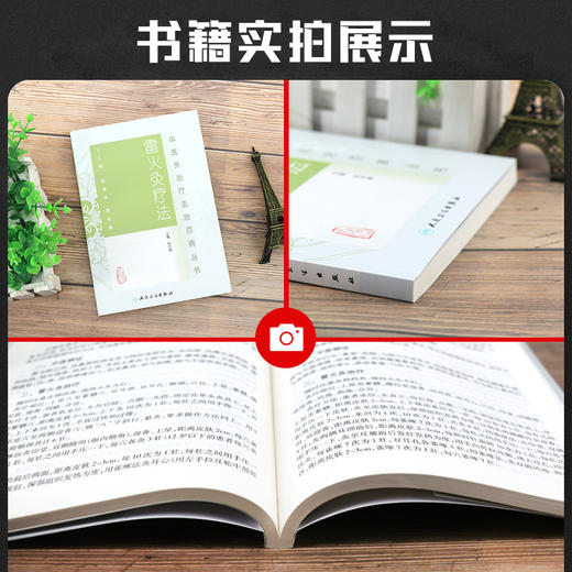 雷火灸疗法 中医外治疗法治百病丛书 赵时碧主编 中医针灸中医基础理论 雷火灸临床实践主要疾病 人民卫生出版社9787117188111 商品图2