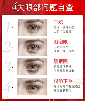 4大眼部问题自查