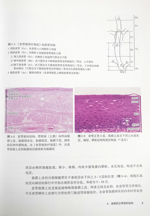 消化道病理及活检诊断图谱 中村恭一  等著 消化系统疾病活体组织检查 影像诊断图谱胃食管疾病 辽宁科学技术出版社9787559123503 商品图4