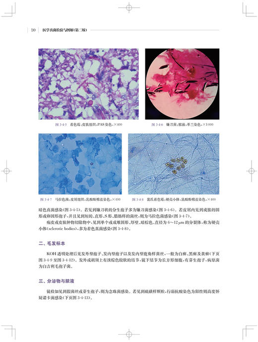 医学真菌检验与图解 第二版 医学真菌图谱真菌检验备查书 临床医学书籍 卢洪洲 徐和平 冯长海 上海科学技术出版社9787547858790 商品图4