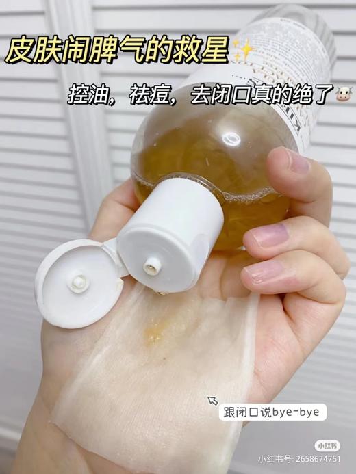 科颜氏金盏花水 250ml/500ml  祛痘淡化痘印  控油保湿  调理舒缓肌肤 商品图7
