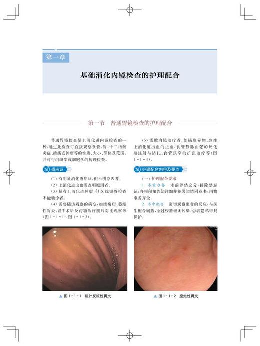 消化内镜护理配合与管理 王亚玲 曹艳主编 内科护理人员日常工作指导疑难问题解决方案 消化内科 上海科学技术出版社9787547858745 商品图4