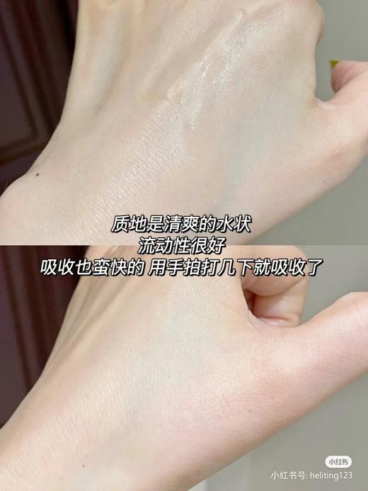 科颜氏金盏花水 250ml/500ml  祛痘淡化痘印  控油保湿  调理舒缓肌肤 商品图10