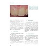 微创牙齿美学修复 商品缩略图1