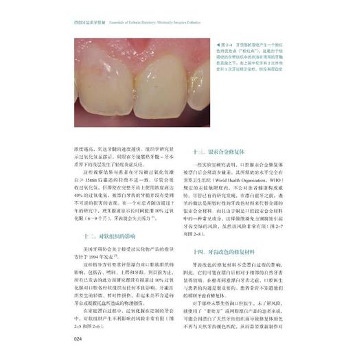 微创牙齿美学修复 商品图1