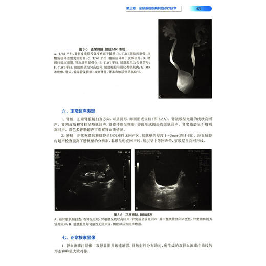 区域临床检验与病理规范教程 泌尿系统疾病 涂建成 王行环主编 泌尿系统疾病概论诊断流程鉴别病理 人民卫生出版社9787117298902 商品图3