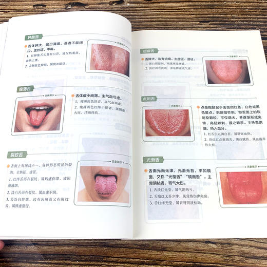 【9.9元包邮】全新正版彩图全解舌诊图谱观舌知健康 舌诊辩证图谱 图解中医舌诊基础理论手诊面诊罗大伦书舌诊诊断教程中医看舌苔调理书中医养生 商品图4