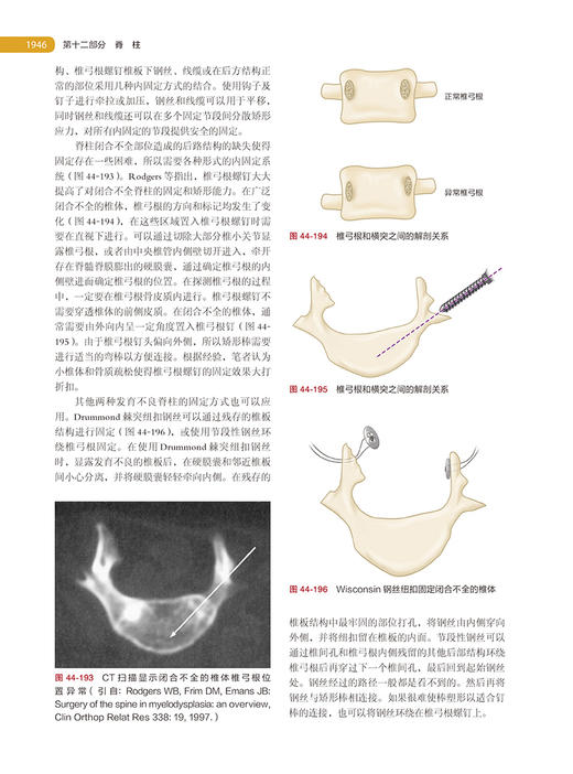 坎贝尔骨科手术学 第14版 第3卷 脊柱外科 唐佩福 卢世璧等译 世界骨科权威经典著作 外科手术 北京大学医学出版社9787565925832 商品图4