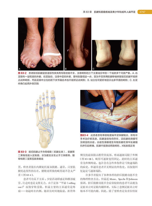 坎贝尔骨科手术学第14版 第7卷 足踝外科 唐佩福 王岩 卢世璧等译 世界骨科权威经典著作 外科学 北京大学医学出版社9787565925610 商品图3