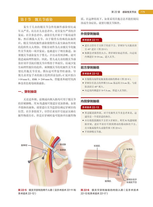 坎贝尔骨科手术学 第14版 第2卷 感染肿瘤儿童骨科 唐佩福 卢世璧等译 世界骨科权威经典著作 北京大学医学出版社9787565925627 商品图4