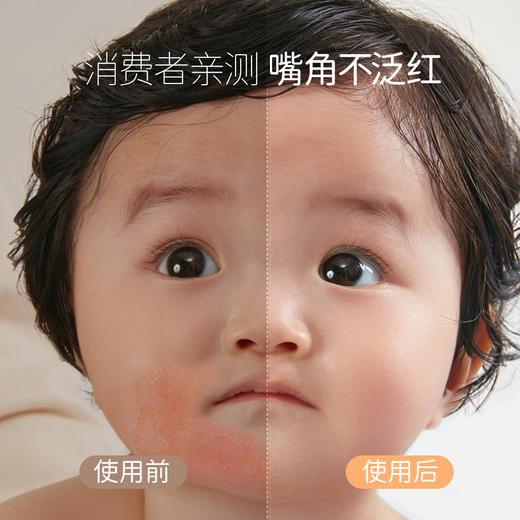 【戴可思推荐】新品婴儿唇周霜宝宝口水膏唇周护理滋润保湿乳液面霜疹15g 商品图1