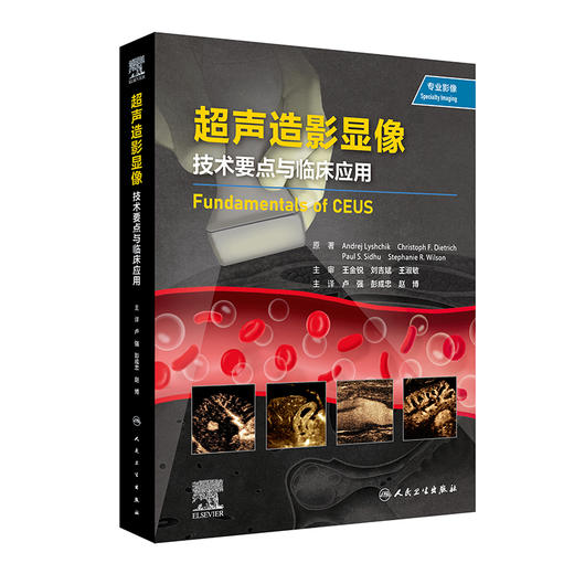 超声造影显像：技术要点与临床应用 2023年1月参考书 9787117330985 商品图0