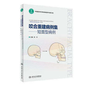 咬合重建病例集——短面型病例 2023年1月参考书 9787117337946