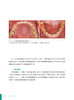 咬合重建病例集 短面型病例 刘洋主编 中国医药学术原创精品图书出版工程 口腔颌面部疾病矫形外科学 人民卫生出版社9787117337946 商品缩略图4