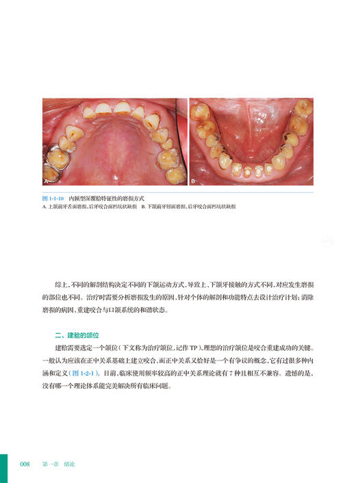 咬合重建病例集 短面型病例 刘洋主编 中国医药学术原创精品图书出版工程 口腔颌面部疾病矫形外科学 人民卫生出版社9787117337946 商品图4