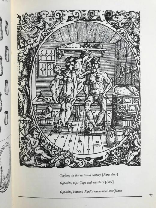 古代治疗艺术图集 数十幅插图 精装16开 商品图14