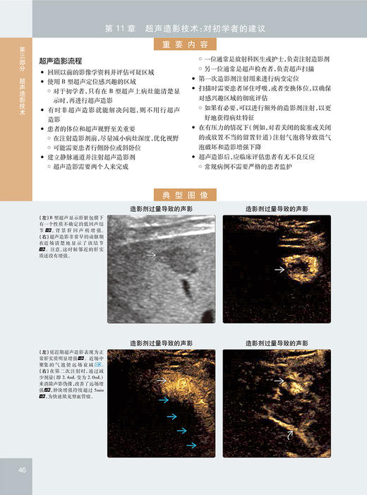 超声造影显像 技术要点与临床应用 卢强赵博等译 超声造影经典专著 超声或其他影像及临床医师工具书 人民卫生出版社9787117330985 商品图4