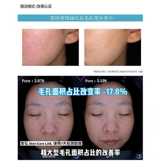 【1.9 大牌再降价】refa射频美容仪RAISE发光机（柜价4000+） 商品图6