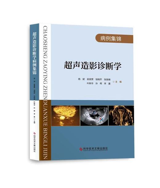 【附送U盘，内含93个教学视频】《超声造影诊断学》主编 杨斌 吴意赟 钱晓芹 张丽娟 叶新华 孙晖 李嘉 主编 商品图0