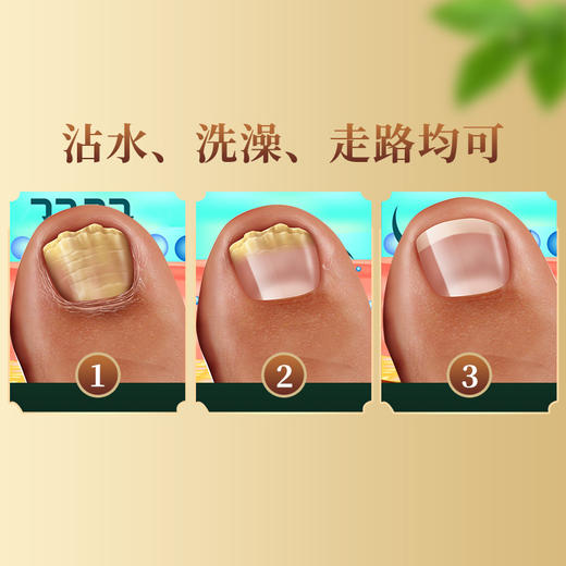 【轻松一滴！白云山灰指甲修护液】轻松一滴，深层渗透，草生yijun，趾甲黑厚水软甲膏足部软甲甲桉液30ML/瓶 商品图3