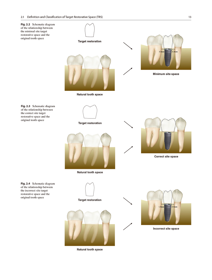 33985(YZ) (10).jpg