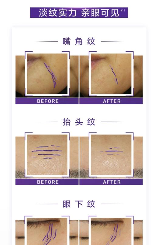 欧莱雅复颜玻尿酸水光充盈全脸淡纹眼霜 商品图7