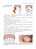 无托槽隐形矫治技术 郭润智 张云帆 黄一平主译 口腔正畸 错牙合畸形临床治疗中隐形矫治器应用 辽宁科学技术出版社9787559126450 商品缩略图3