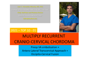 TOP1.多次复发的颅颈交界处脊索瘤