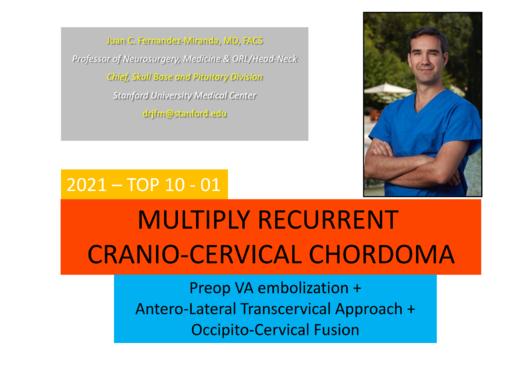 TOP1.多次复发的颅颈交界处脊索瘤 商品图0