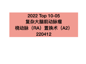 TOP5.复杂大脑前动脉瘤桡动脉（RA）置换术（A2）