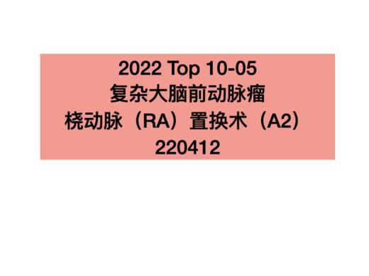 TOP5.复杂大脑前动脉瘤桡动脉（RA）置换术（A2） 商品图0