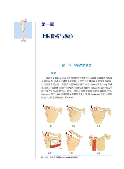 骨折三维立体分型观测 叶哲伟主编 常见部位骨折脱位分型常用治疗方式 配骨折分型三维立体3D图像 人民卫生出版社9787117336871 商品图3